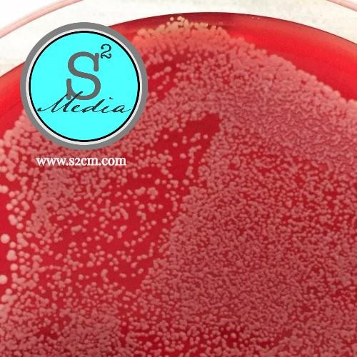pea agar with 5% sheep blood, 16x90mm plate