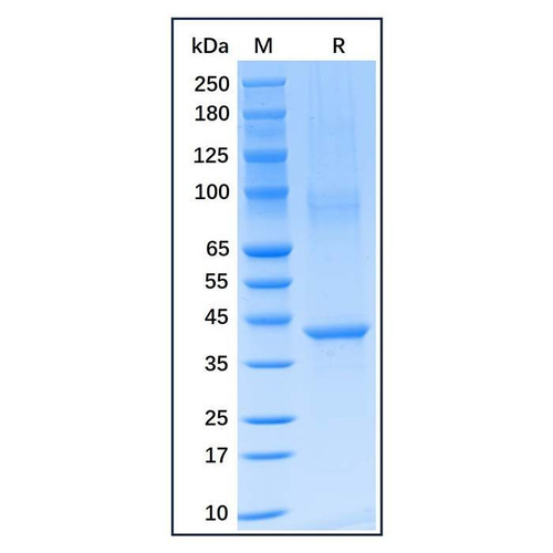 recombinant human aurora b protein (c09-1186-187)