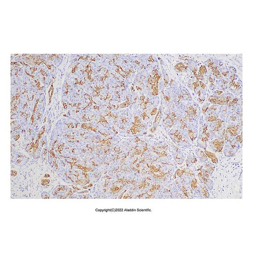 recombinant ca19-9 antibody (c09-1935-380)