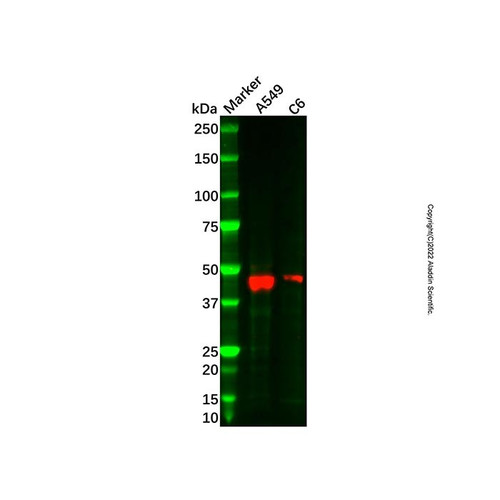 pancreatic lipase/ptl antibody (c09-1938-313)