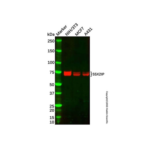 recombinant ssx2ip antibody (c09-1939-182)