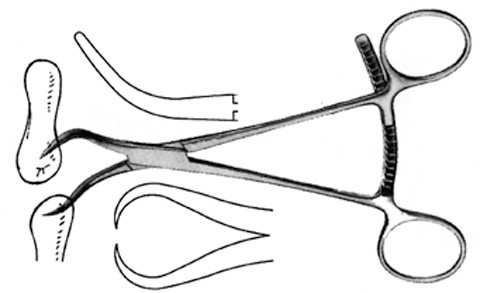 Bone Redn Forceps Curved 6 3/4", One Tip Step Pointed S1359-1140