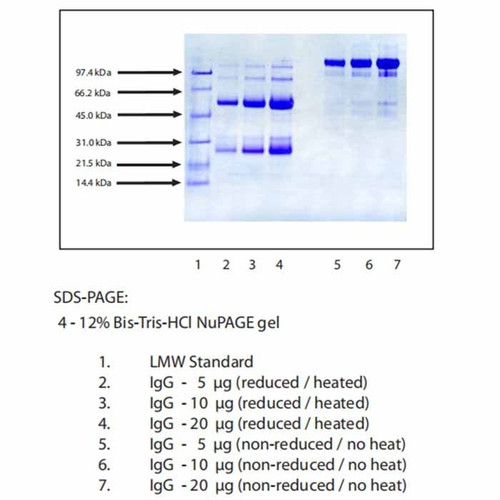 immunoglobulin g (igg), normal human plasma (c007b-590270)