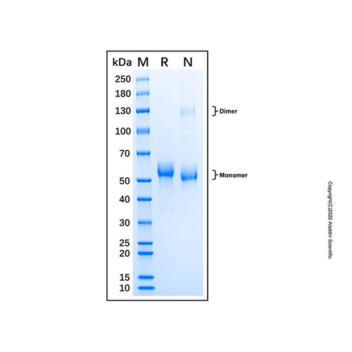 recombinant human cathepsin c/dppi protein (c007b-676798)