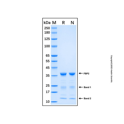 recombinant human fbp2 protein (c007b-676899)