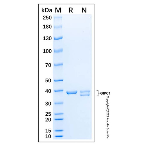 recombinant human gipc1 protein (c007b-676906)