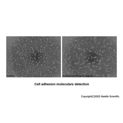 recombinant human osteopontin (opn-a) protein (c007b-676941)
