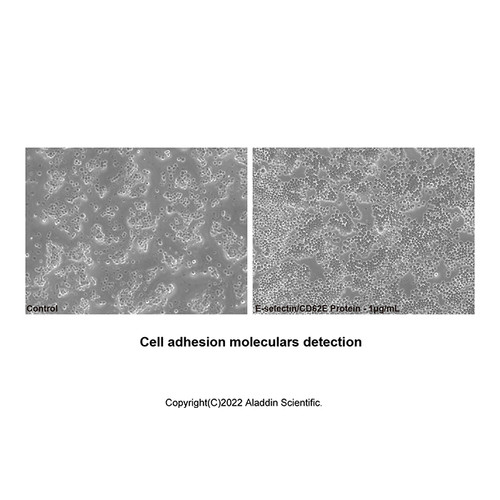 recombinant human e-selectin/cd62e protein (c007b-676963)