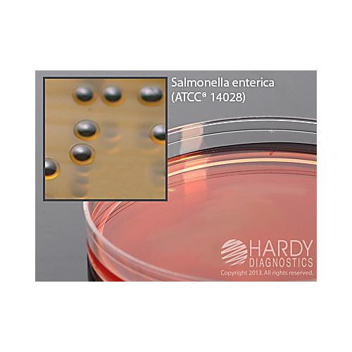 ss (salmonella shigella) agar, 15x100mm plate