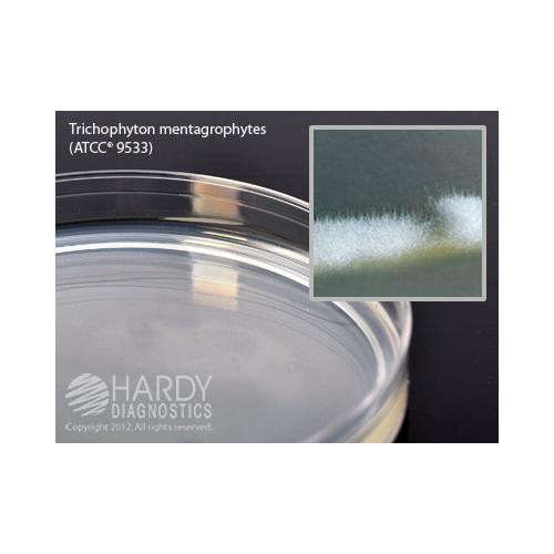 potato dextrose agar, usp, deep fill, 15x100mm plate