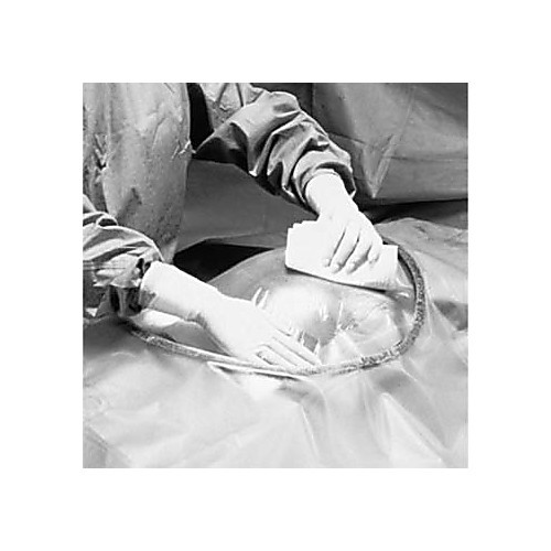 cesarean-section with incise pouch, 35" x 30", 10/bx, 4 bx/cs (us only)