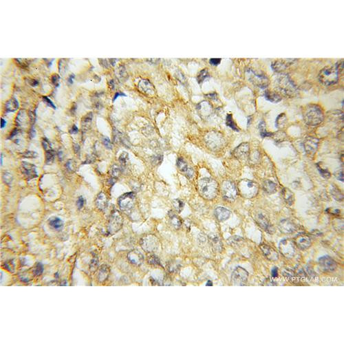 rarres3 rabbit polyclonal antibody (12065-1-ap)