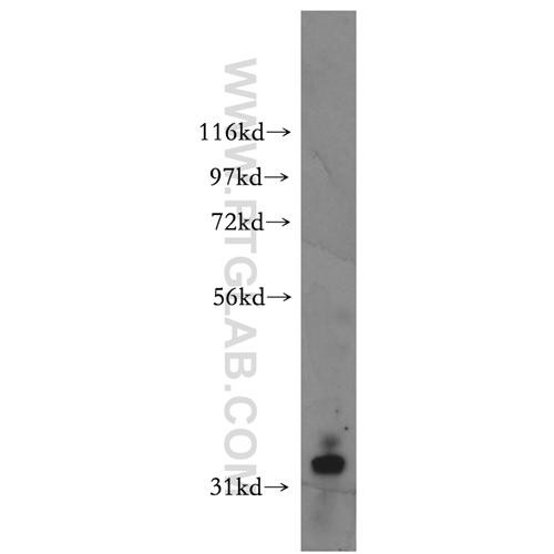 sfrp2 rabbit polyclonal antibody (12189-1-ap)