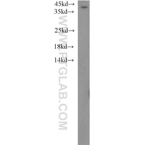 abhd5 rabbit polyclonal antibody (12201-1-ap)