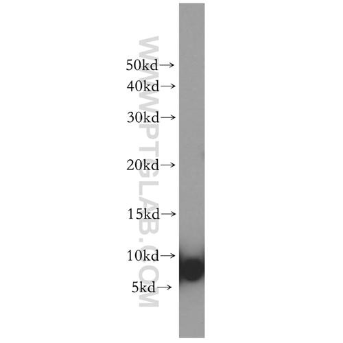 s100a3 rabbit polyclonal antibody (12343-1-ap)