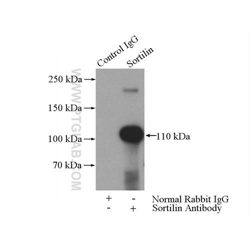 sort1 rabbit polyclonal antibody (12369-1-ap)