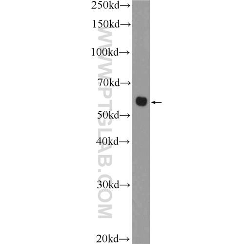 chst1 rabbit polyclonal antibody (12504-1-ap)
