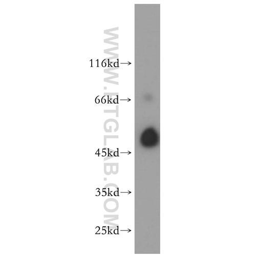 alg1 rabbit polyclonal antibody (12872-1-ap)