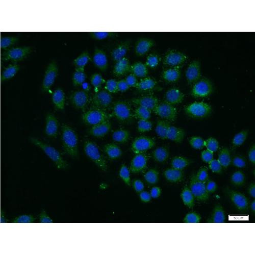 pxn rabbit polyclonal antibody (10029-1-ig)