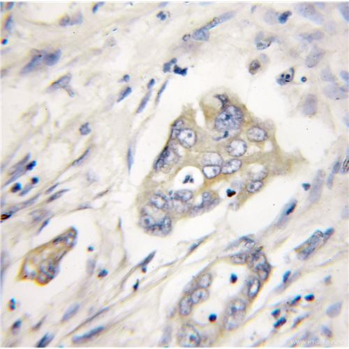 xiap rabbit polyclonal antibody (10037-1-ig)