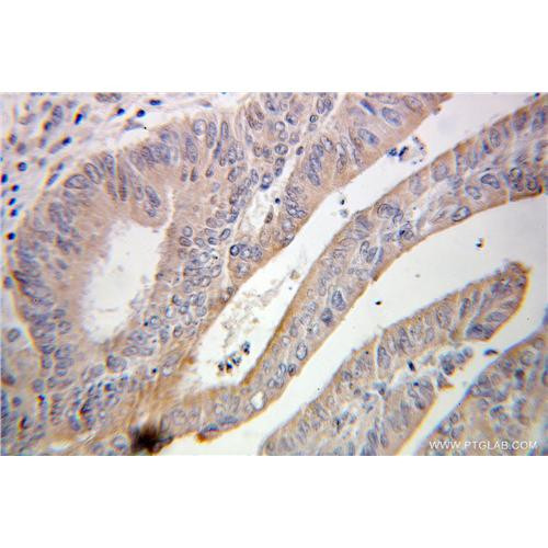 abcf2 rabbit polyclonal antibody (10226-1-ap)