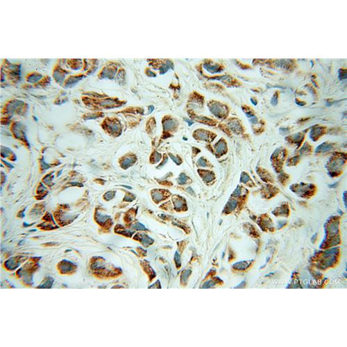 chrna3 rabbit polyclonal antibody (10333-1-ap)