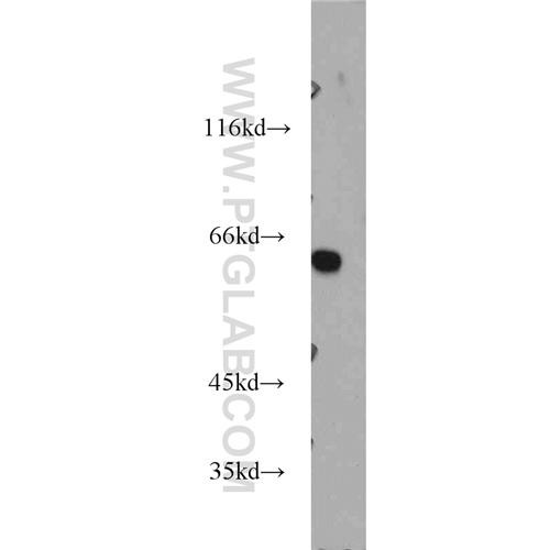 ahcyl1 rabbit polyclonal antibody (10658-3-ap)