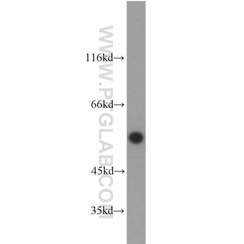 etv4 rabbit polyclonal antibody (10684-1-ap)