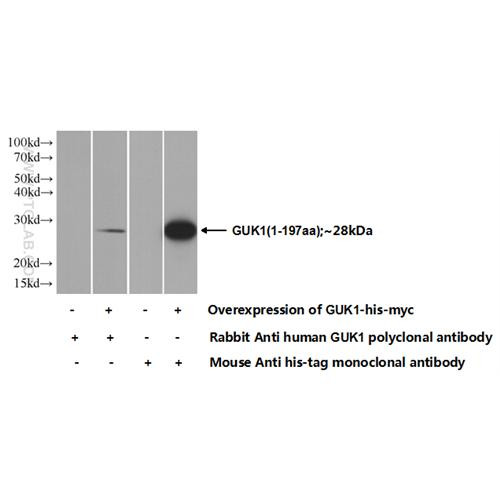 guk1 rabbit polyclonal antibody (10755-1-ap)