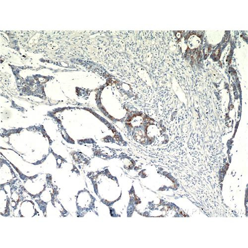 sprr3 rabbit polyclonal antibody (11742-1-ap)