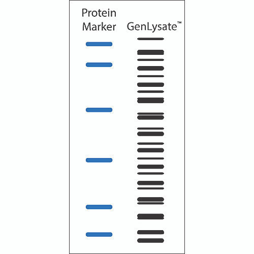 human normal ovary single tissue blot, 1 blot