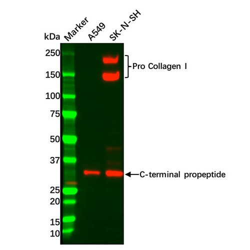 collagen i antibody (c09-0740-660)