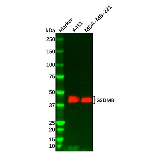 gsdmb antibody (c09-0741-335)