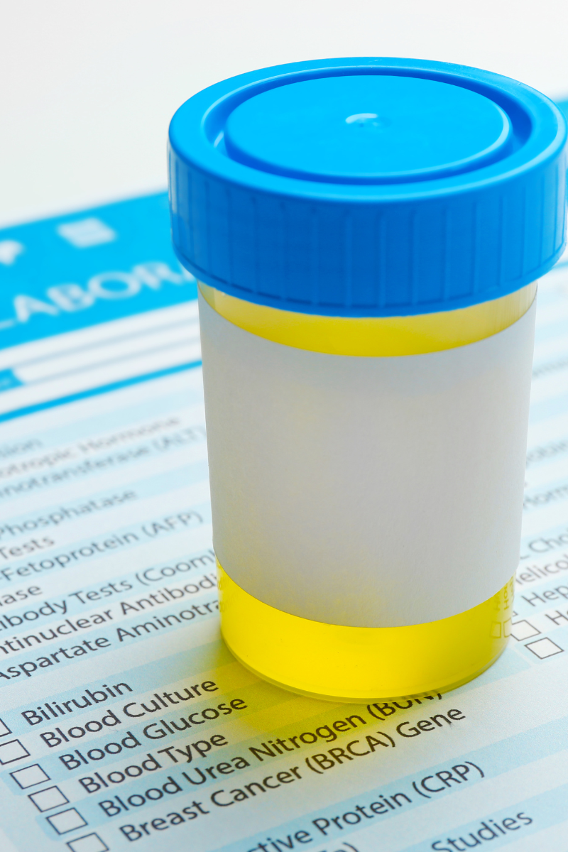 Conquer Chaos: Streamlining Your Specimen Collection Process - Cenmed ...