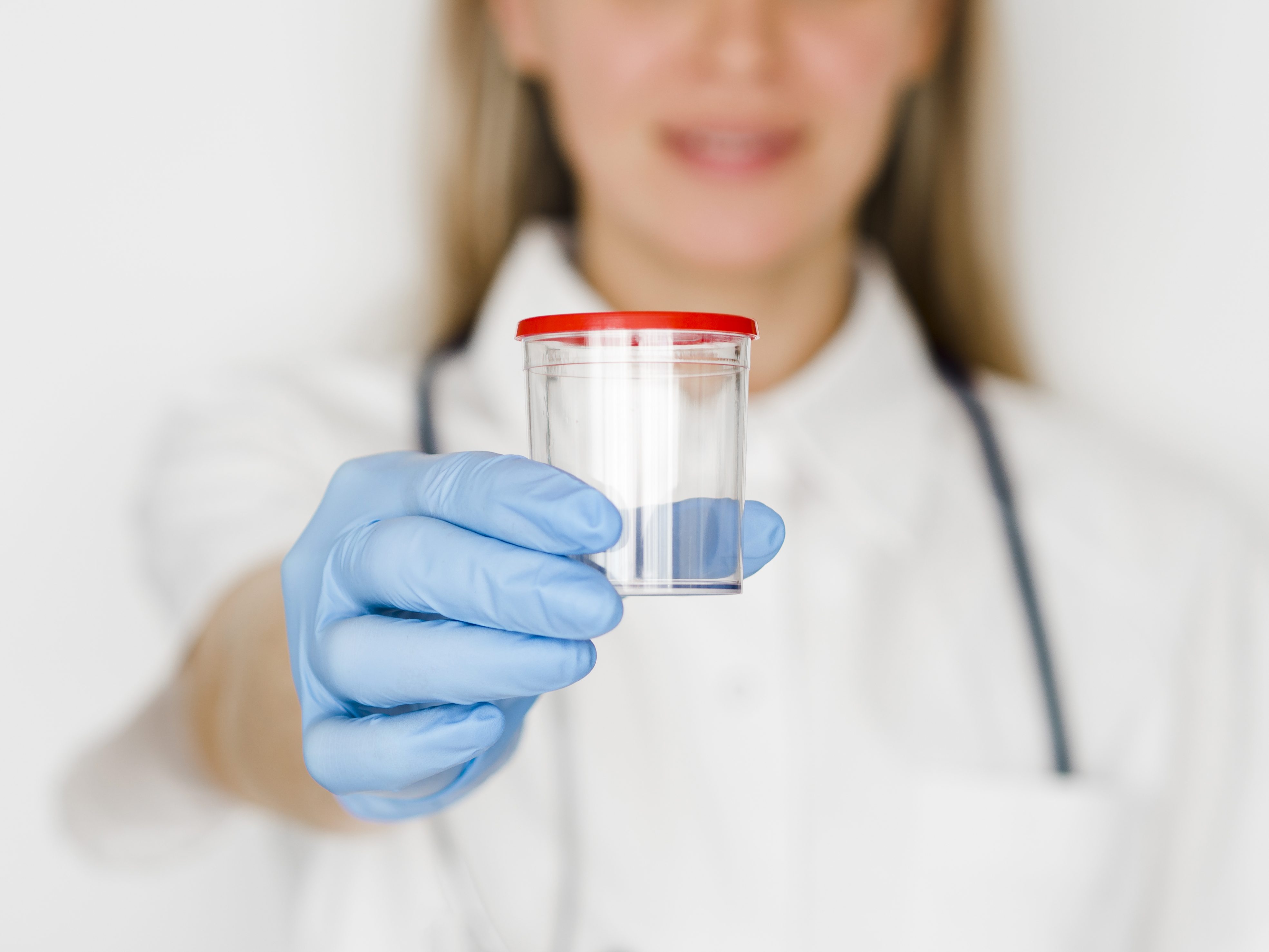 Urine Drug Test Accuracy: What Employers Must Know in 2025