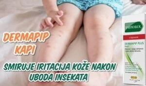 Što kada nas komarci ipak ubodu?