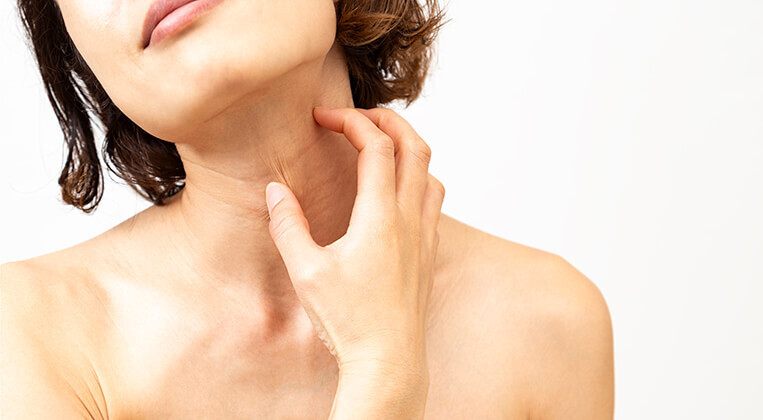 Atopijski dermatitis