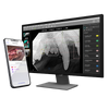Clarity XR Veterinary Imaging Software – Advanced Dental X-Ray
