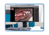 Clarity XR - Veterinary Dental X-Ray Software