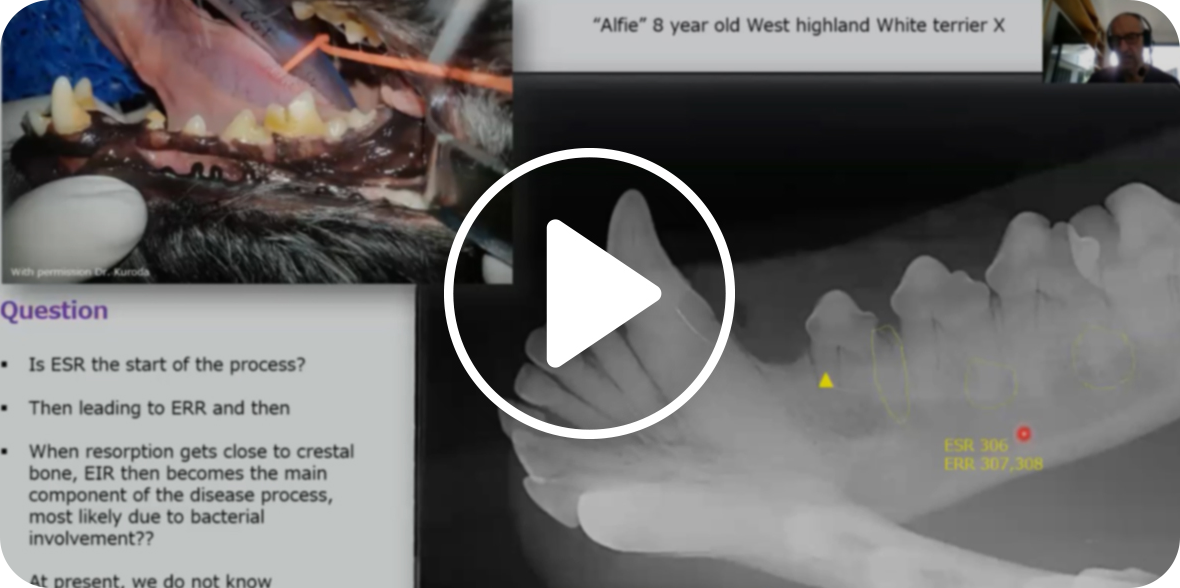 A video demonstrating dental treatment on a tooth, showcasing the procedure and techniques used