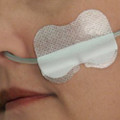 Nasal Gastric Securement Device Grip-Lok Nasal Gastric Securement Device Grip-Lok