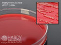 Prepared Media Tryptic Soy Agar (TSA) with 5% Sheep Blood Red Petri Plate Format