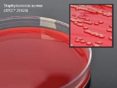 Prepared Media Brucella Blood Agar with Hemin and Vitamin K Red Petri Plate Format Prepared Media Brucella Blood Agar with Hemin and Vitamin K Red Petri Plate Format