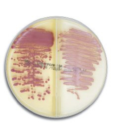 Prepared Media BBL CHROMagar Methicillin Resistant Staphylococcus Aureus (MRSA) / Staph Aureus Bi-Plate Prepared Media BBL CHROMagar Methicillin Resistant Staphylococcus Aureus (MRSA) / Staph Aureus Bi-Plate