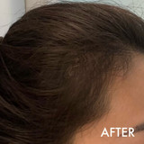 Hairloss Control Shampoo
