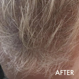 Hairloss Control Shampoo