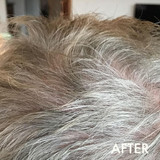 Hairloss Control Shampoo