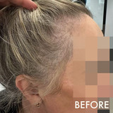 Hairloss Control Scalp Lotion