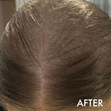 Hairloss Control Scalp Concentrate