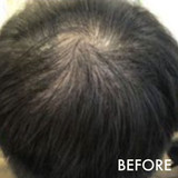 Hairloss Control Scalp Concentrate